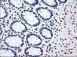 PLK1 Antibody in Immunohistochemistry (Paraffin) (IHC (P))