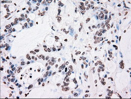 PLK1 Antibody in Immunohistochemistry (Paraffin) (IHC (P))