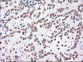 PLK1 Antibody in Immunohistochemistry (Paraffin) (IHC (P))