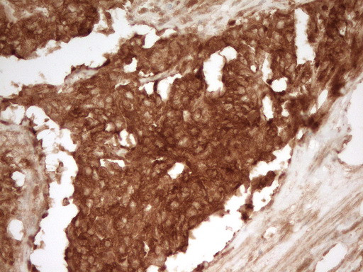 PRMT5 Antibody in Immunohistochemistry (Paraffin) (IHC (P))