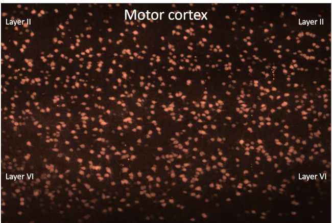 Parvalbumin Antibody in Immunohistochemistry (IHC)