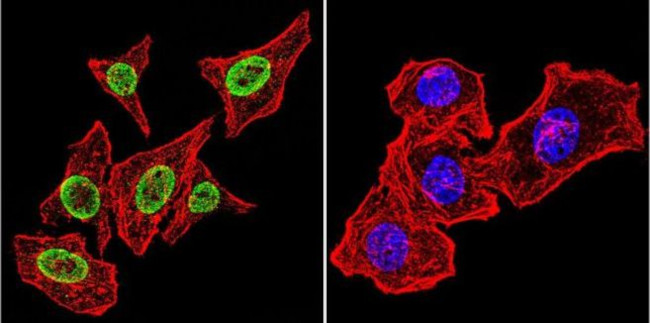 Parvalbumin Antibody in Immunocytochemistry (ICC/IF)