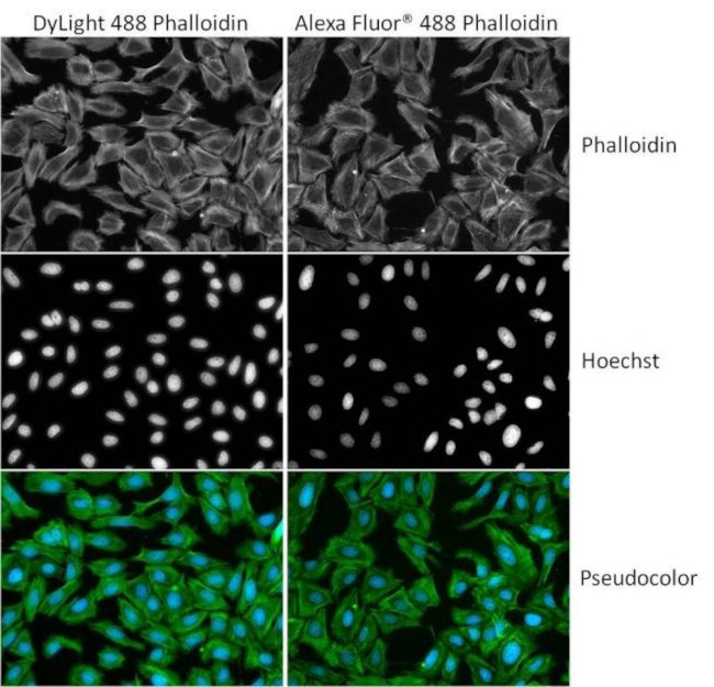 Phalloidin Control in Immunocytochemistry (ICC/IF)