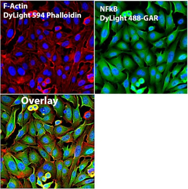 Phalloidin Control in Immunocytochemistry (ICC/IF)