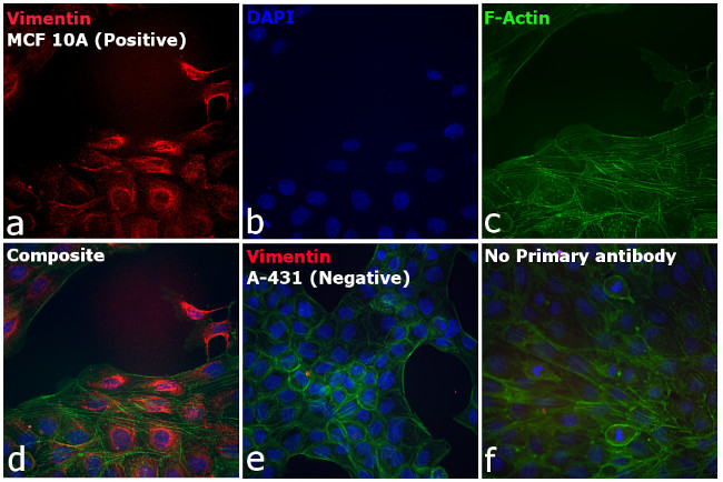 Rabbit IgG (H+L) Secondary Antibody in Immunocytochemistry (ICC/IF)