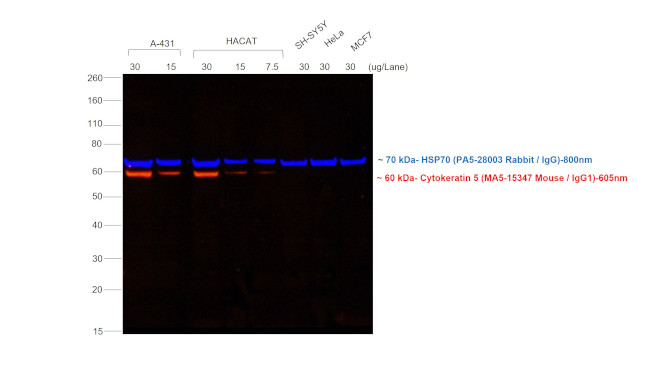 Mouse IgG (H+L) Secondary Antibody in Western Blot (WB)