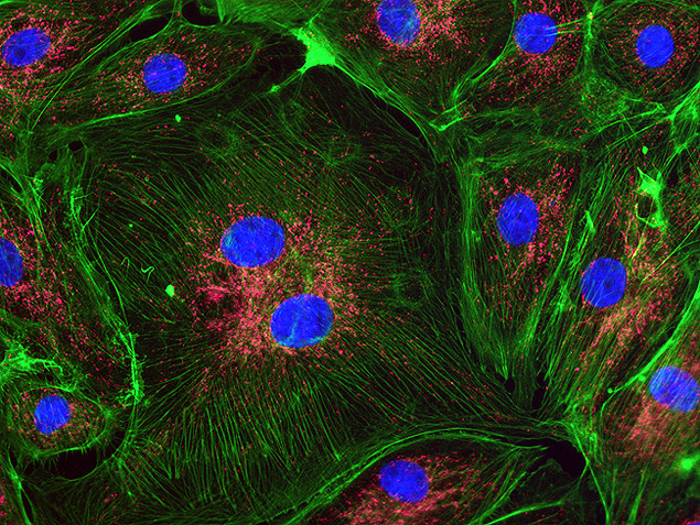 Mouse IgG (H+L) Secondary Antibody in Immunocytochemistry (ICC/IF)