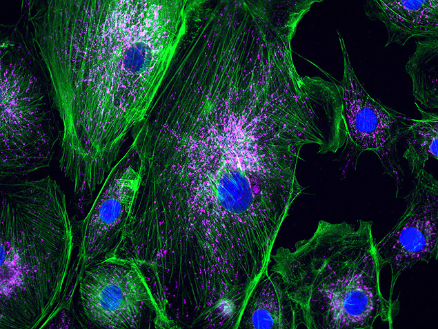 Mouse IgG (H+L) Secondary Antibody in Immunocytochemistry (ICC/IF)