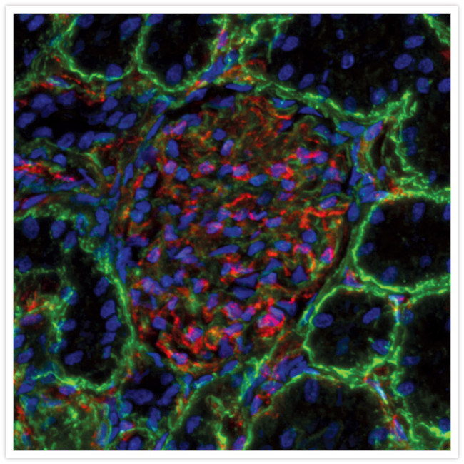 Mouse IgG (H+L) Secondary Antibody in Immunohistochemistry (IHC)