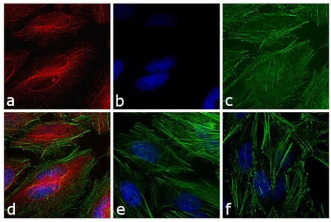 Rabbit IgG (H+L) Secondary Antibody in Immunocytochemistry (ICC/IF)