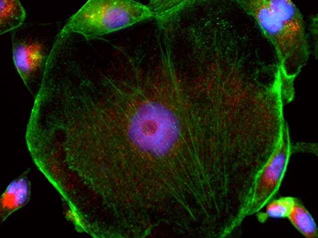 Rabbit IgG (H+L) Cross-Adsorbed Secondary Antibody in Immunocytochemistry (ICC/IF)