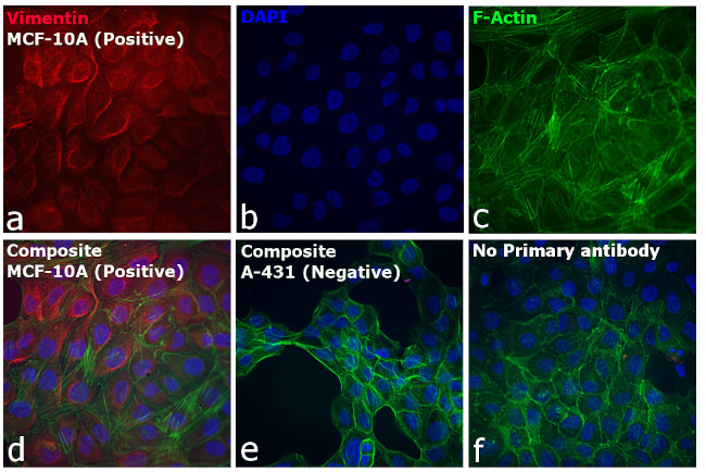 Rabbit IgG (H+L) Cross-Adsorbed Secondary Antibody in Immunocytochemistry (ICC/IF)