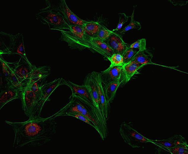 Rabbit IgG (H+L) Secondary Antibody in Immunocytochemistry (ICC/IF)