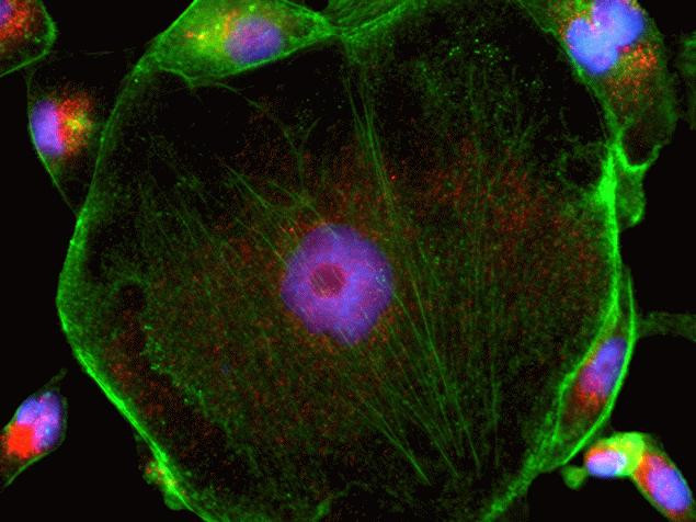 Rabbit IgG (H+L) Secondary Antibody in Immunocytochemistry (ICC/IF)