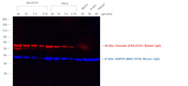 Rabbit IgG (H+L) Secondary Antibody in Western Blot (WB)