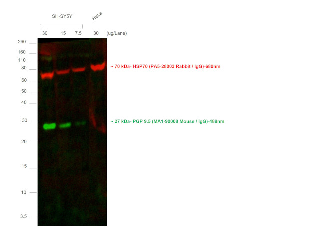 Mouse IgG (H+L) Cross-Adsorbed Secondary Antibody in Western Blot (WB)