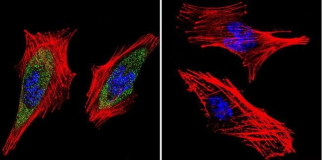 RAB9 Antibody in Immunocytochemistry (ICC/IF)