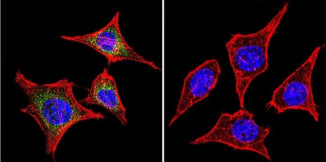 RAB9 Antibody in Immunocytochemistry (ICC/IF)