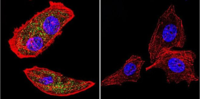 RAB9 Antibody in Immunocytochemistry (ICC/IF)