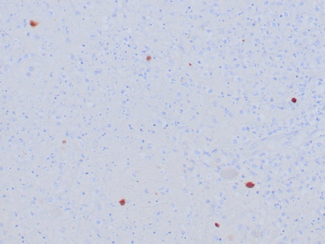 HSV1 (Herpes Simplex Virus Type I) Antibody in Immunohistochemistry (Paraffin) (IHC (P))