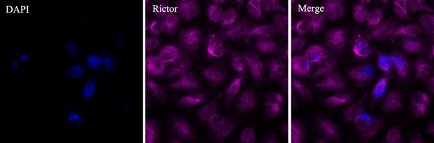 RICTOR Antibody in Immunocytochemistry (ICC/IF)