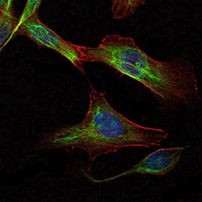 RICTOR Antibody in Immunocytochemistry (ICC/IF)