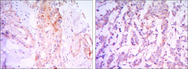 RICTOR Antibody in Immunohistochemistry (Paraffin) (IHC (P))