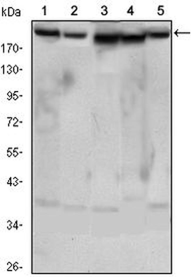 RICTOR Antibody in Western Blot (WB)