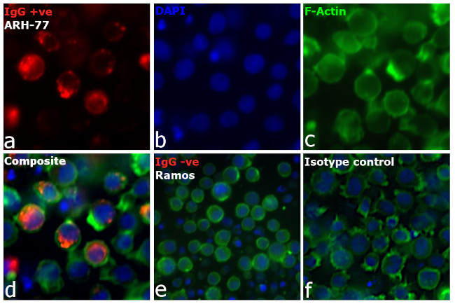 Human IgG Fc Cross-Adsorbed Secondary Antibody in Immunocytochemistry (ICC/IF)