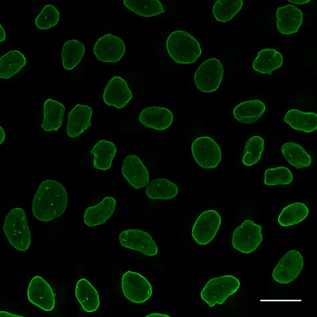 Rabbit IgG Nano (VHH) Secondary Antibody in Immunocytochemistry (ICC/IF)