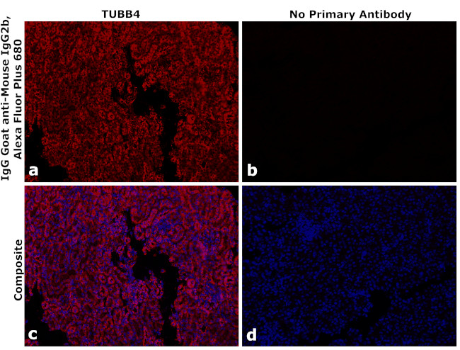 Mouse IgG2b Secondary Antibody in Immunohistochemistry (Paraffin) (IHC (P))