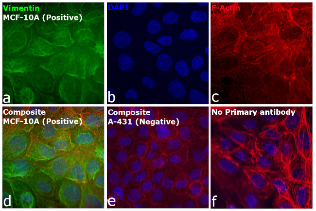 Rabbit IgG (H+L) Secondary Antibody in Immunocytochemistry (ICC/IF)