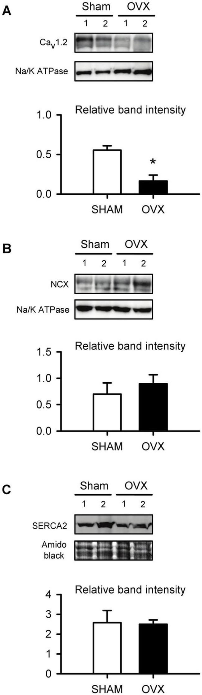 SERCA2 ATPase Antibody in Western Blot (WB)