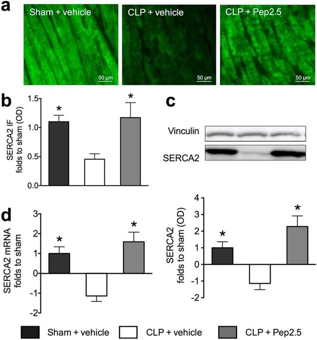 SERCA2 ATPase Antibody in Western Blot, Immunohistochemistry (WB, IHC)