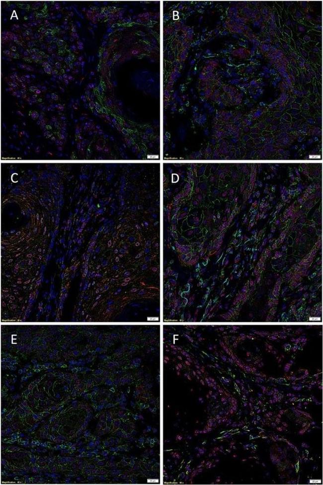 SOX2 Antibody in Immunohistochemistry (Paraffin) (IHC (P))