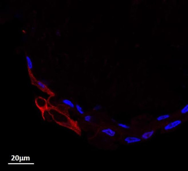 STAT3 Antibody in Immunohistochemistry (Paraffin) (IHC (P))