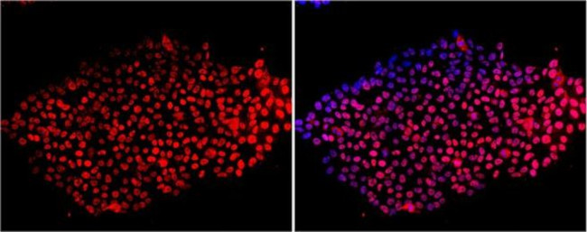 SOX2 Antibody in Immunocytochemistry (ICC/IF)