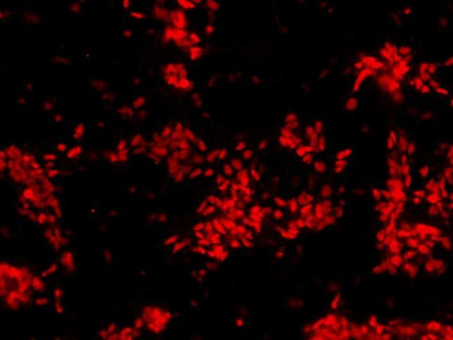 SOX2 Antibody in Immunocytochemistry (ICC/IF)