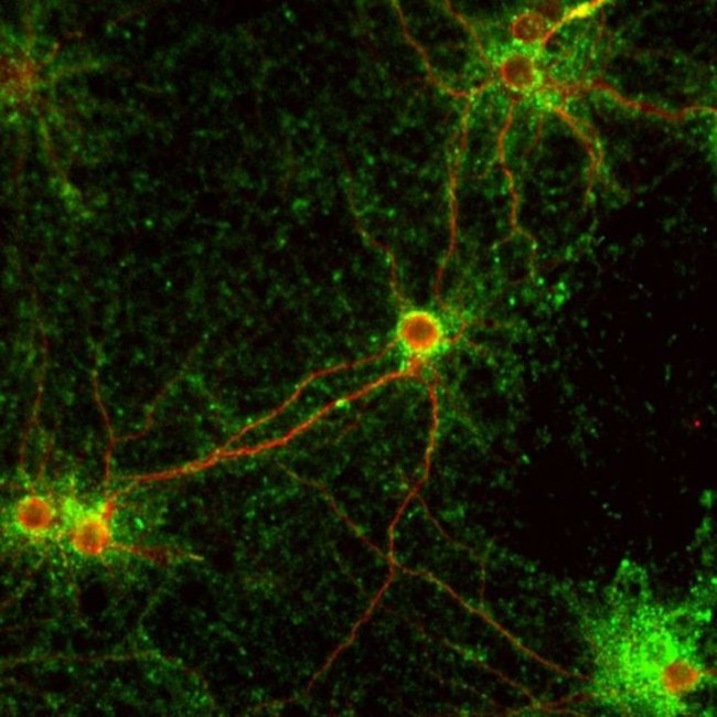 Synaptophysin Antibody in Immunocytochemistry (ICC/IF)