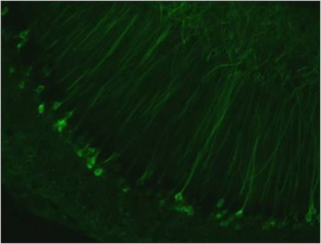 Tau Antibody in Immunohistochemistry - Free Floating (IHC (Free))