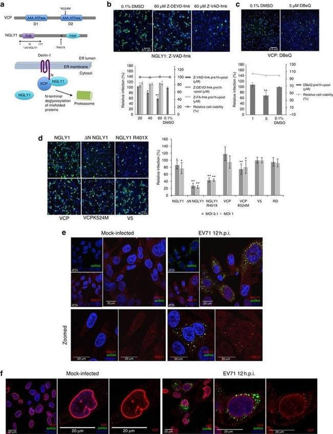 VCP Antibody in Immunocytochemistry (ICC/IF)