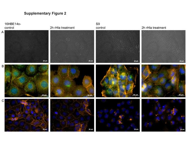 Vinculin Antibody in Immunocytochemistry (ICC/IF)