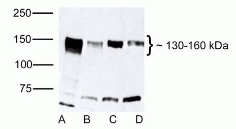 ZO-2 Antibody in Western Blot (WB)