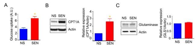 Glutaminase Antibody in Western Blot (WB)