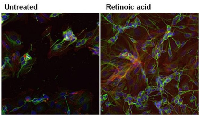 beta-3 Tubulin Antibody in Immunocytochemistry (ICC/IF)