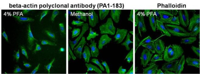 beta Actin Antibody in Immunocytochemistry (ICC/IF)