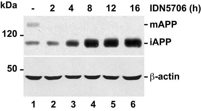 beta Amyloid Antibody in Western Blot (WB)