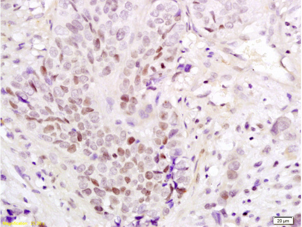 PAX3 Antibody in Immunohistochemistry (Paraffin) (IHC (P))