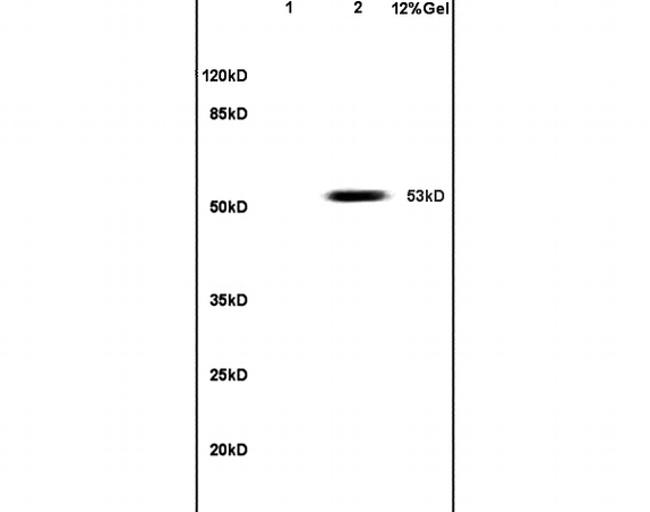 PAX3 Antibody in Western Blot (WB)