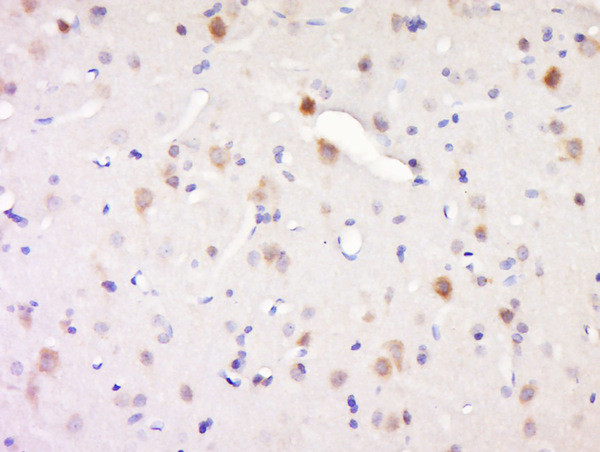 Synaptojanin 1 Antibody in Immunohistochemistry (Paraffin) (IHC (P))